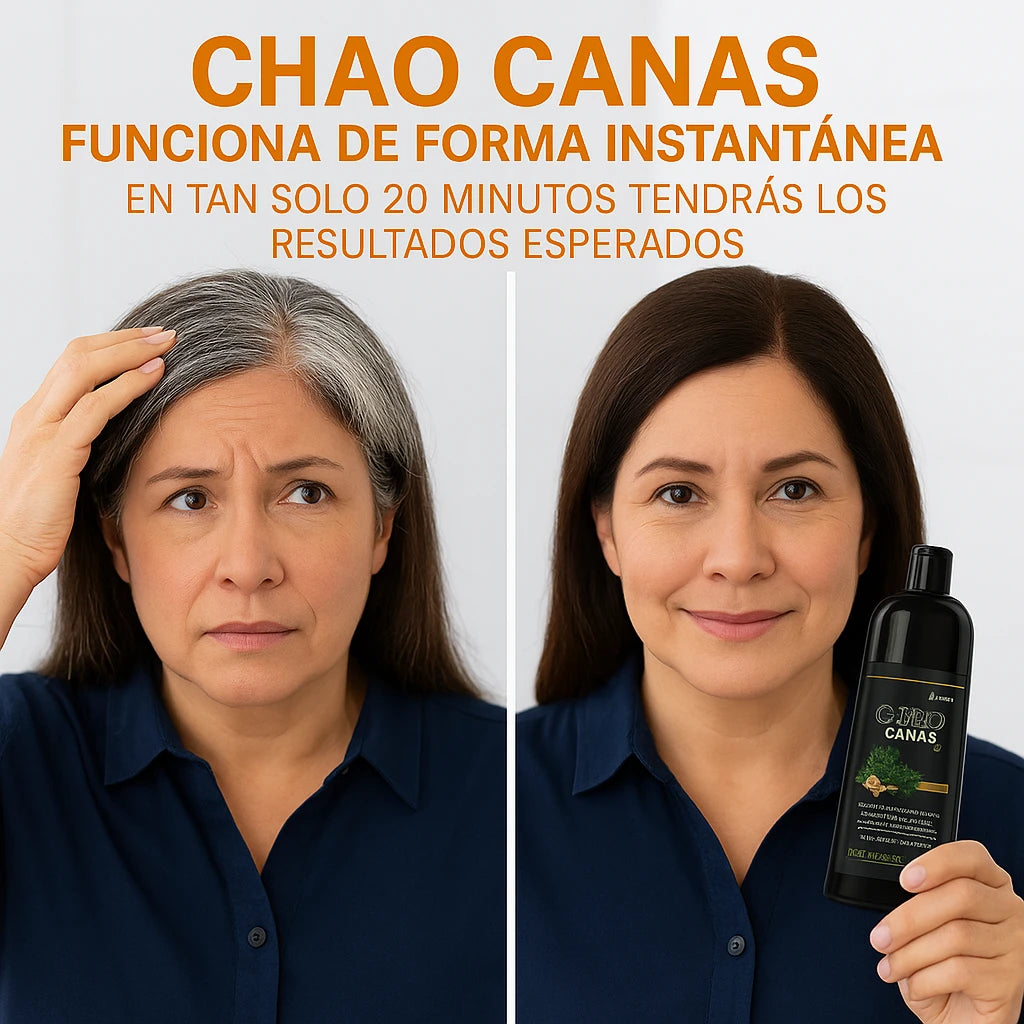 KID CHAO CANAS + TRATAMENTIENTO - Dile adiós a las canas y revitaliza tu cabello en minutos
